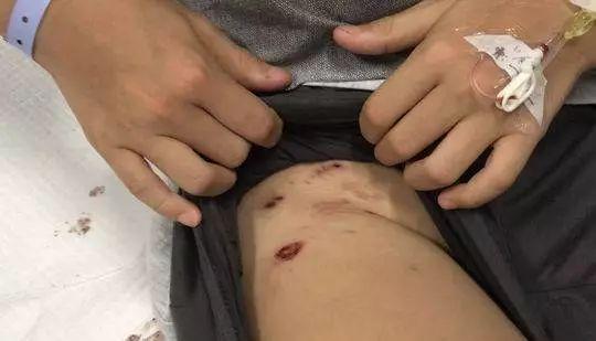 港彩二四六天天好资料和7岁男孩遭3只犬撕咬与7岁男孩遭3只犬撕咬怎么办